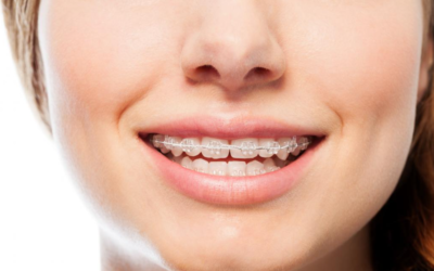 Exploring Orthodontics Services: What You Need to Know